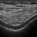 본큐어한의원 이미지