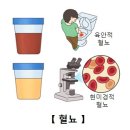 전이성 신장암[Kidney, cancer, metastatic]신장비뇨기질환, 종양혈액질환 이미지