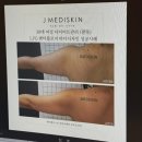 제이메디 | [송도] '제이메디스킨' 웨딩드레스 라인 엔더몰로지 관리 효과 후기