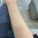 진천가톨릭피부과의원 네이버블로그