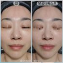 하나로드림(주) | 피부를 ‘잘 보이게’가 아니라 ‘잘 흐르게’ 만드는 관리 모공디톡스 후기 | 올가드림뷰티 봉선점