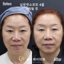 실루엣의원 이미지