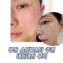 부산덴탈 | 부산 스킨부스터 추천 리투오 내돈내산 2회차 후기