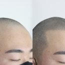 스칼프디자인센터 이미지