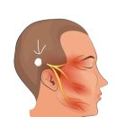 오른쪽 귀 뒤가 찌릿하면서 아픈데 제발 이거 무슨 증상인지 아는 사람 ㅠㅠㅠ 이미지