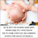 유아 아토피 치료법 한의원 후기입니다