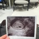 성하리 | 임신 - 4주~8주간의 기록 (분만병원 결정, 산후조리원 예약, 초음파 앨범 구매)