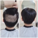 모모즈헤어&증모