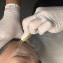 유비슈가링왁싱 | [의정부] 슈가엘뷰티 왁싱 민락점, 슈가링 왁싱