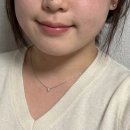 클리어레이저 | 여의도 피부과 전문의 입 주위 여드름 치료 아비클리어 레이저 후기