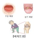 병도 이미지