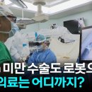 1mm 미만 혈관수술도 로봇으로...로봇 의료는 어디까지? 이미지
