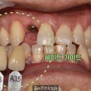 신흥치과기공소 이미지