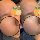 오닉스스킨테라피 | [미용]센트라스피부관리/오닉스스킨테라피/방문후기