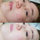 스킨앤바디측천무후 네이버블로그