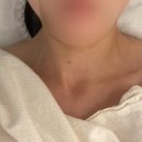 하솜에스테틱 네이버블로그