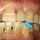 복음치과기공소 이미지