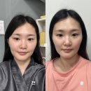 트리메드 | 서면 웨딩 얼굴관리 라메드에스테틱 얼굴 특수관리 후기