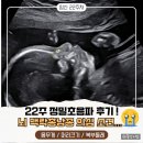 11545-10-22-24 | [임신 22주차] 정밀초음파 후기 : 가슴 철렁했던 맥락총낭종 의심·소멸 기록!(태아 크기/콧대/사진多)