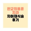 판교 최용훈치과의원 | 판교최용훈치과•치아재식술 당일 후기•통증•비용•수술시간