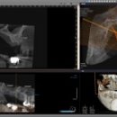 이세상치과기공소 이미지