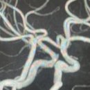 이광수신경과의원 이미지