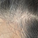 부산 맘모스헤어라인의원 이미지