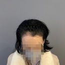 S헤어라인