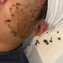 세븐일레븐 광주운암경신점 | 광주 운암동 피부관리 더헤스트에서 모공관리 흉터케어 받고왔어요