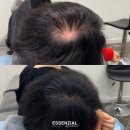 파주시야당보건진료소 | 고양시 파주 두피문신 정수리·가르마 상담 후기