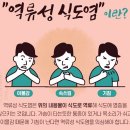 질병 "식도염 Esophagitis" 이미지