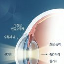 119종합광고 | 노안 수술 비용 종류 및 치명적인 부작용 후기 예방