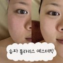 폴라리스컨설팅 | 잠실에스테틱 추천! 폴라리스 에스테틱 개인 맞춤형 윤곽관리 상세후기