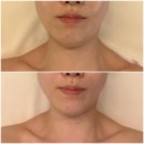 새망미메디칼빌딩 | 부산 피부관리 경락 에스테틱 미인가 백년가게 윤곽관리 전문