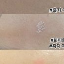 써니메디컬 이미지