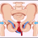 대퇴부경부골절? OO 놓치면 악화될 수 있습니다 이미지