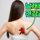 왼쪽 날개뼈 통증 더이상 방치 마세요 이미지