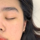 조헤어라인 이미지