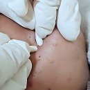 지에스(GS)25운정라피아노점 | 피부 고민 종결자 등장 운정 여드름관리 제대로 하는 곳 찾았음