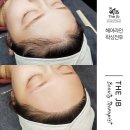 제이비라인 이미지