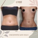 르로제의원 네이버블로그