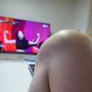 차종식피부과의원 | 두드러기로 갔던 대전 둔산동 D피부과..하.. (결론은 차종식)