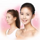 AJ성형외과 네이버블로그