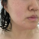 효쑥뜸 | 시흥디톡스 시흥쑥뜸 쑥뜸천하 시흥은행점 디톡스후기