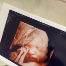 우리맘산부인과의원 이미지