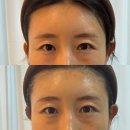 (주)웰스메디칼 | [의정부 피부관리] 가꾸는동안&amp;숲칼프 의정부교육센터에서 윤곽관리받은 후기