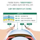 로운안과의원 이미지