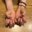 (주)가나안제이시스템 | 서울 도봉 :: 물어뜯는 손톱 교정 4차 후기 이제 진짜 아트 직전 쌍문역 네일 마스터제이네일 변신 기록