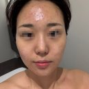 통기타힐링테라피 Ⅱ | 전문적인 맞춤케어로 달라진 피부컨디션 오산피부관리(아크네 시그니처 후기) ::윙밸스킨 오산점