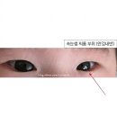 동탄퍼스트안과의원 | ​신생아 아래 속눈썹 찌름 &amp; 눈곱 고민, 소아안과 다녀온 후기 (동탄 샤일리안과의원)